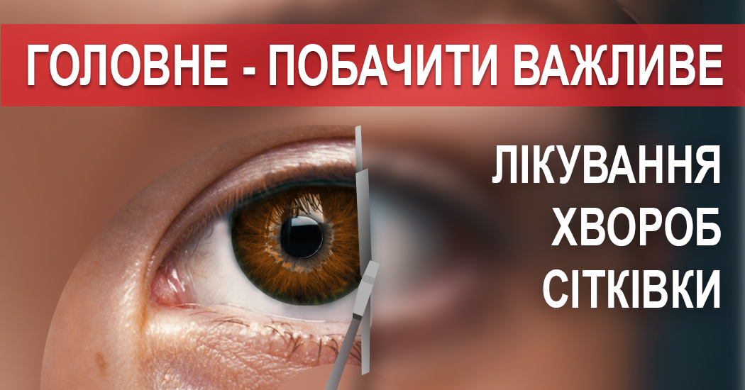 Окуляри для зору, оправи для окулярів, контактні лінзи ✔️ салон ОПТИКА 1.0 - центр зору